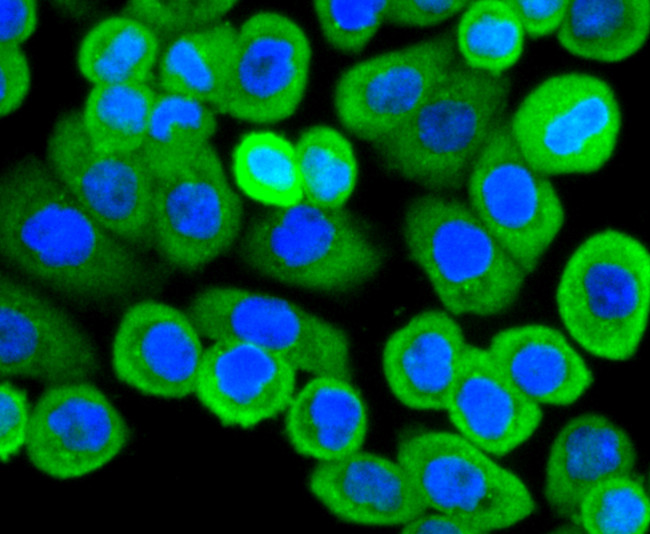 Actin Antibody in Immunocytochemistry (ICC/IF)