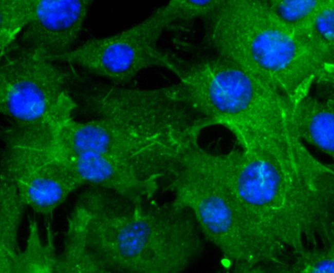 Actin Antibody in Immunocytochemistry (ICC/IF)