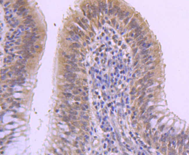 MKP-1 Antibody in Immunohistochemistry (Paraffin) (IHC (P))