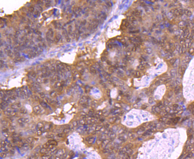 4EBP1 Antibody in Immunohistochemistry (Paraffin) (IHC (P))