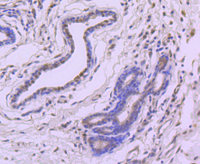 4EBP1 Antibody in Immunohistochemistry (Paraffin) (IHC (P))