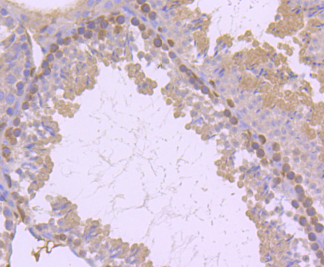 PKC delta Antibody in Immunohistochemistry (Paraffin) (IHC (P))