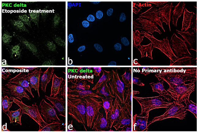 PKC delta Antibody in Immunocytochemistry (ICC/IF)