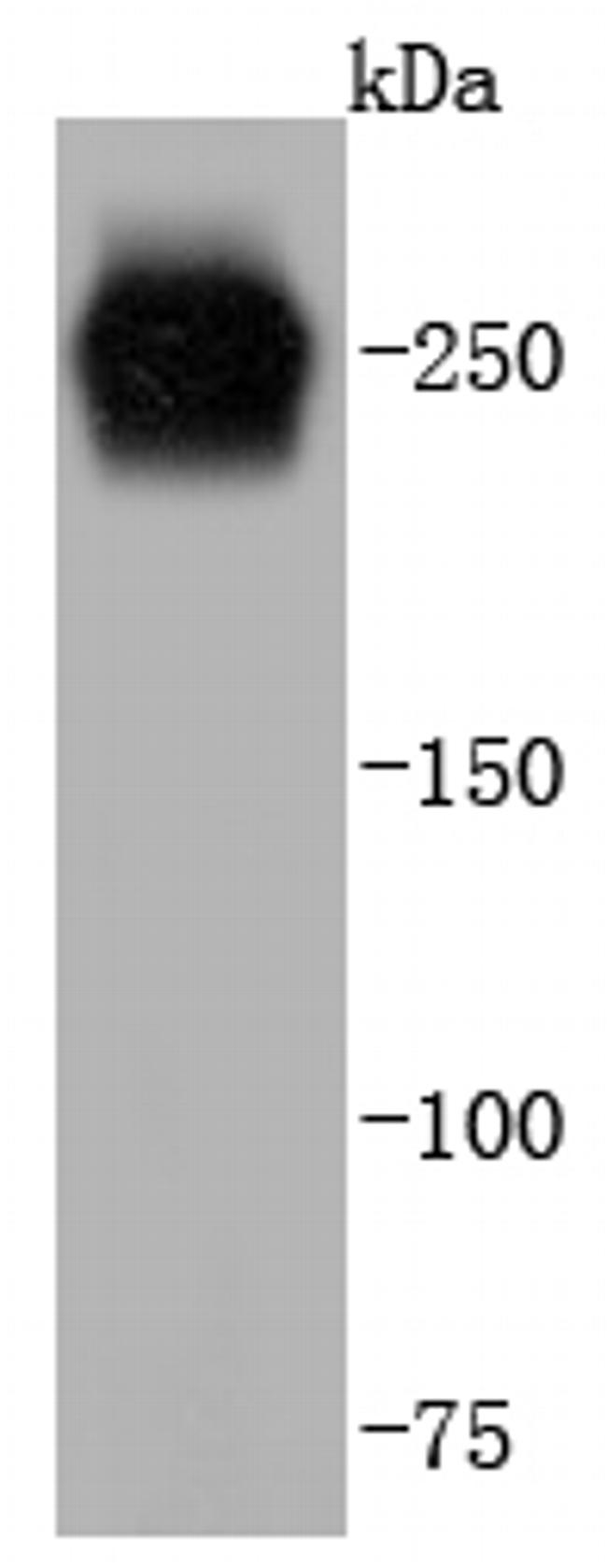 VWF Antibody in Western Blot (WB)