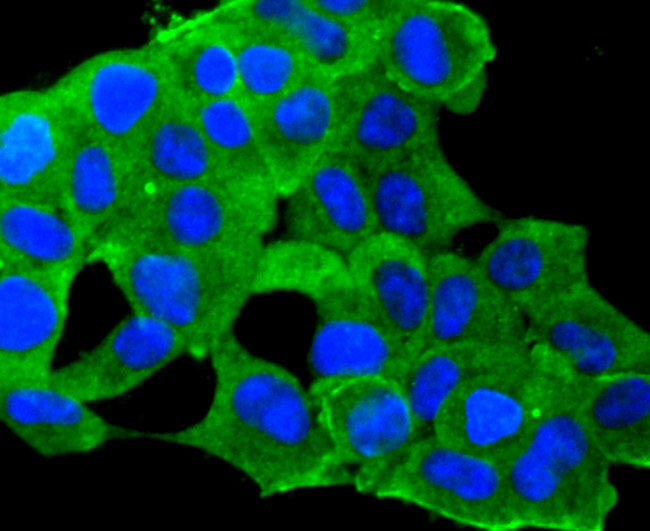 IGF2 Antibody in Immunocytochemistry (ICC/IF)