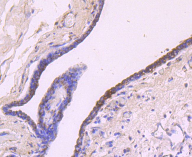 IGF2 Antibody in Immunohistochemistry (Paraffin) (IHC (P))