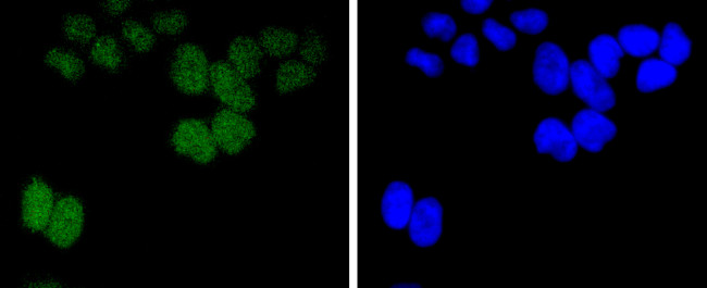 BMI-1 Antibody in Immunocytochemistry (ICC/IF)