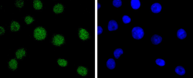 BMI-1 Antibody in Immunocytochemistry (ICC/IF)