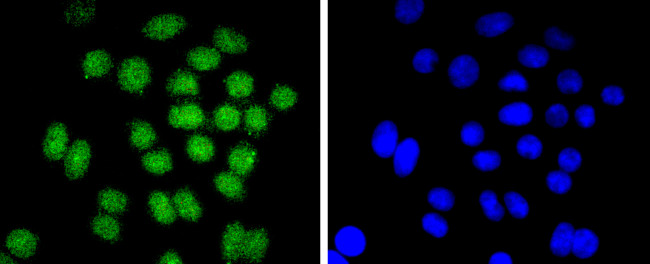 BMI-1 Antibody in Immunocytochemistry (ICC/IF)