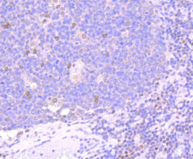 BMI-1 Antibody in Immunohistochemistry (Paraffin) (IHC (P))