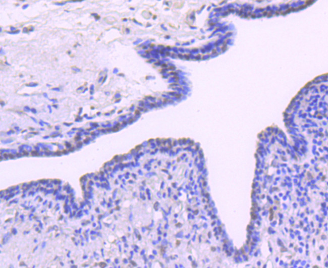 BMI-1 Antibody in Immunohistochemistry (Paraffin) (IHC (P))