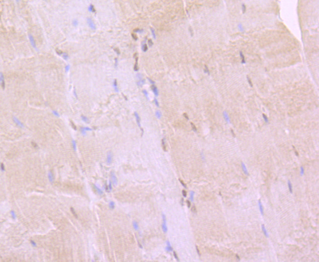 BMI-1 Antibody in Immunohistochemistry (Paraffin) (IHC (P))