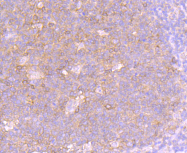 Fas Antibody in Immunohistochemistry (Paraffin) (IHC (P))