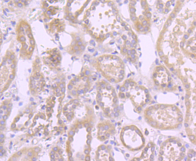 Fas Antibody in Immunohistochemistry (Paraffin) (IHC (P))