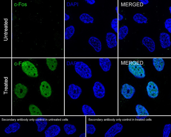 c-Fos Antibody in Immunocytochemistry (ICC/IF)