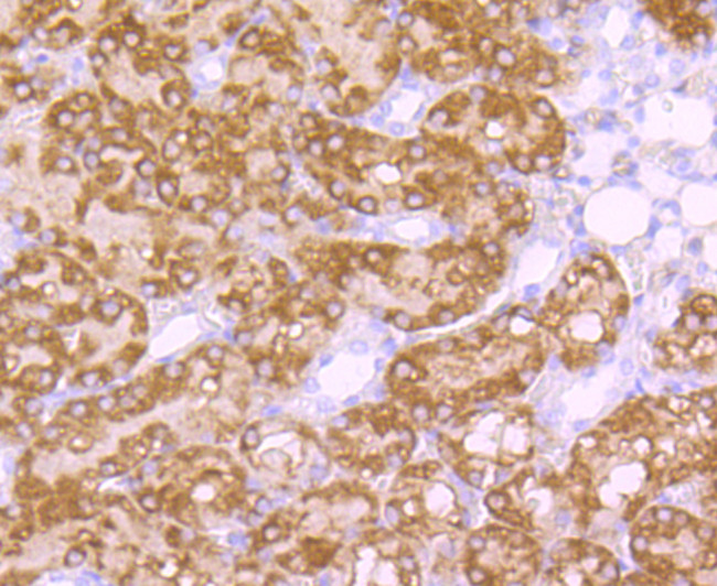 EBP50 Antibody in Immunohistochemistry (Paraffin) (IHC (P))