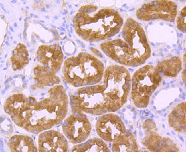 EBP50 Antibody in Immunohistochemistry (Paraffin) (IHC (P))