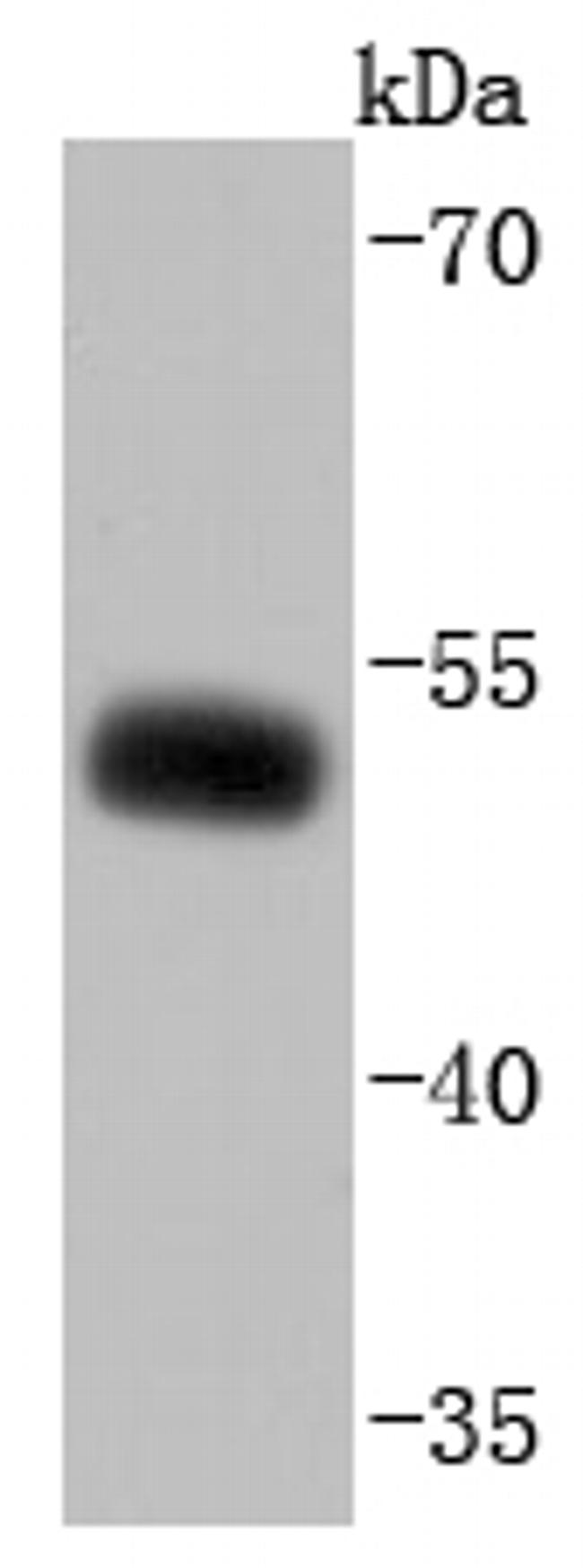 EBP50 Antibody in Western Blot (WB)