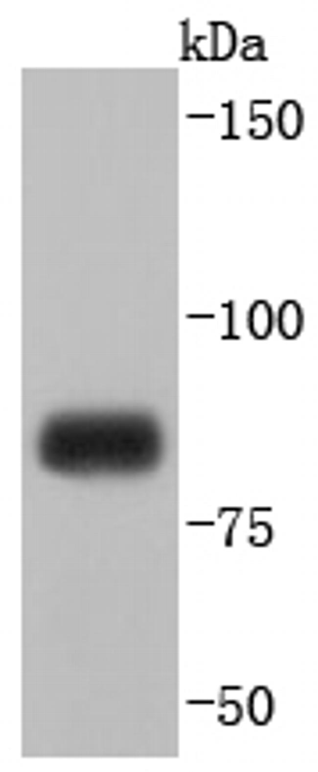 MFN1 Antibody in Western Blot (WB)