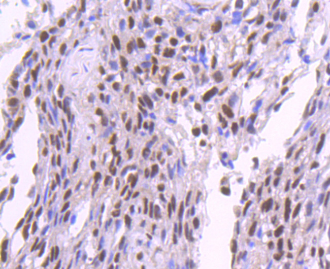 SP1 Antibody in Immunohistochemistry (Paraffin) (IHC (P))