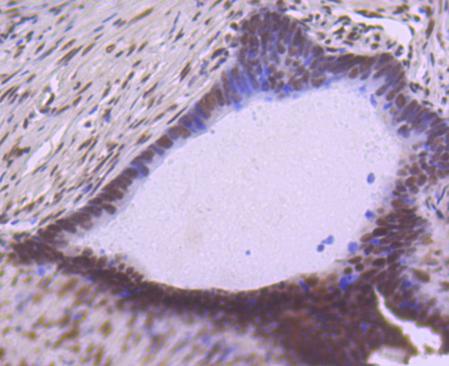 SP1 Antibody in Immunohistochemistry (Paraffin) (IHC (P))