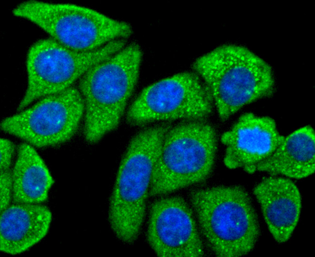 CD206 (MMR) Antibody in Immunocytochemistry (ICC/IF)