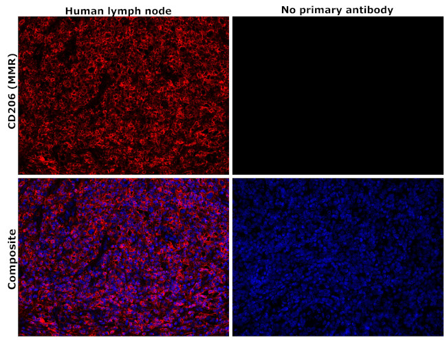 CD206 (MMR) Antibody in Immunohistochemistry (Paraffin) (IHC (P))