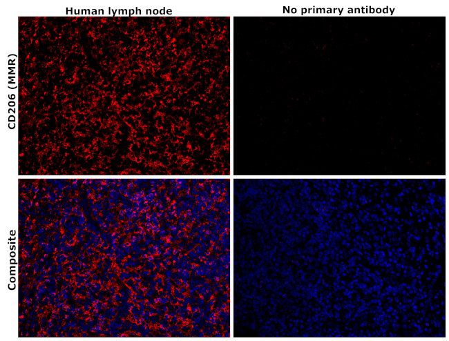 CD206 (MMR) Antibody in Immunohistochemistry (Paraffin) (IHC (P))