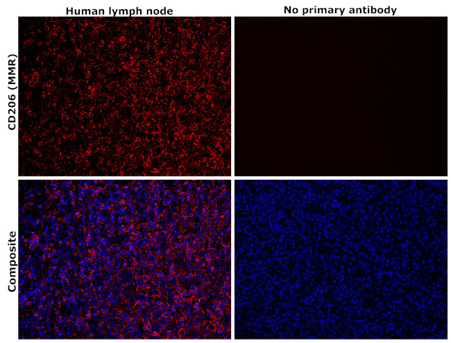 CD206 (MMR) Antibody in Immunohistochemistry (Paraffin) (IHC (P))