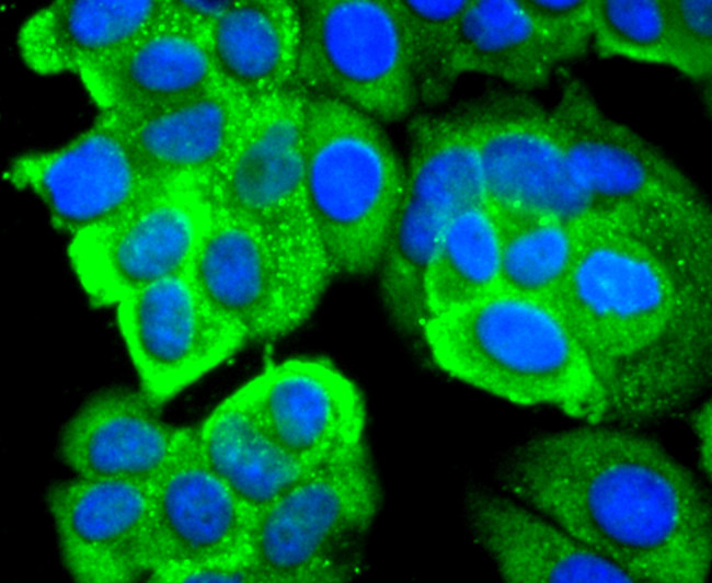 RPSA Antibody in Immunocytochemistry (ICC/IF)