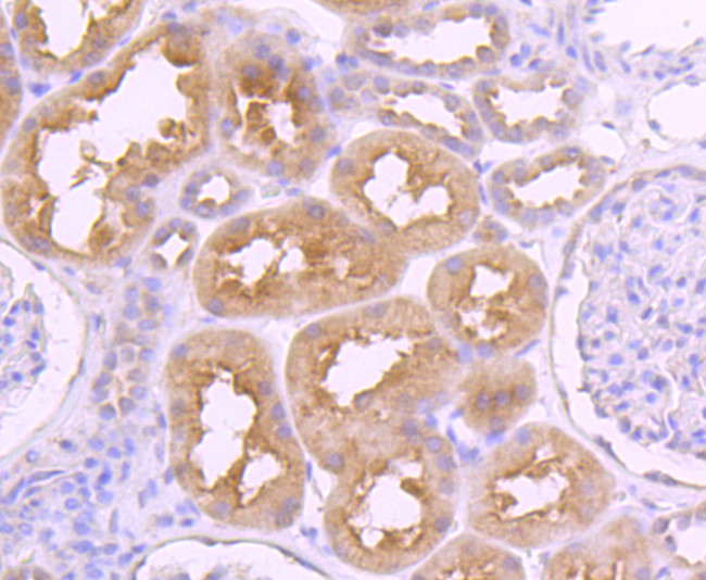 VAMP8 Antibody in Immunohistochemistry (Paraffin) (IHC (P))