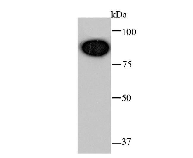 Glucocorticoid Receptor Antibody in Western Blot (WB)