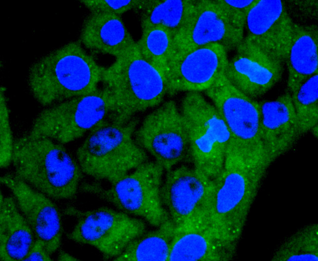 ACSS2 Antibody in Immunocytochemistry (ICC/IF)