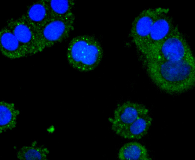 ACSS2 Antibody in Immunocytochemistry (ICC/IF)