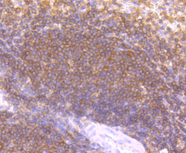 LYVE1 Antibody in Immunohistochemistry (Paraffin) (IHC (P))