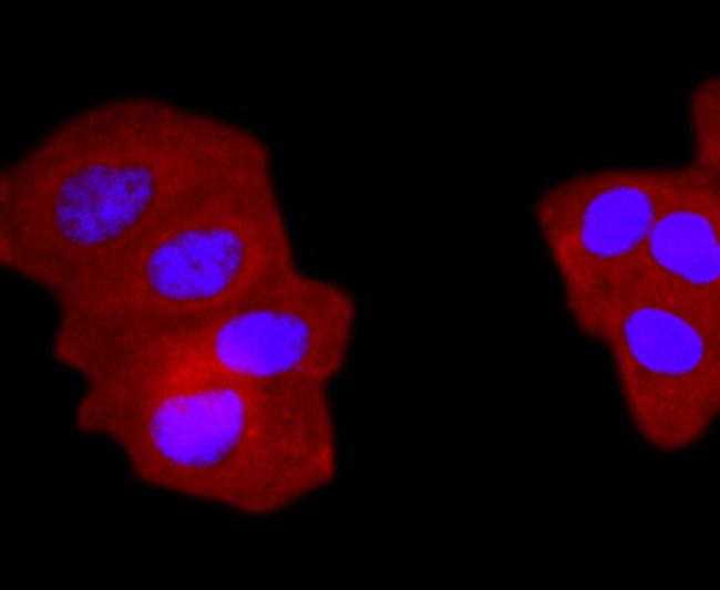 gamma Tubulin Antibody in Immunocytochemistry (ICC/IF)