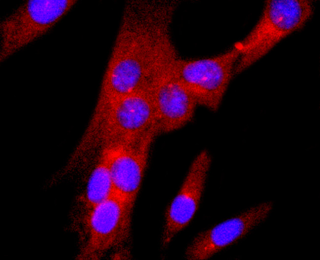 gamma Tubulin Antibody in Immunocytochemistry (ICC/IF)