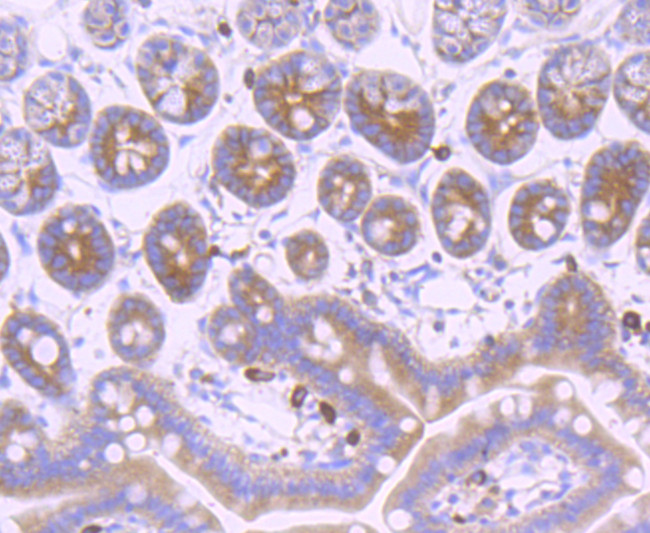 gamma Tubulin Antibody in Immunohistochemistry (Paraffin) (IHC (P))