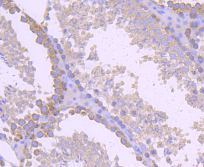 gamma Tubulin Antibody in Immunohistochemistry (Paraffin) (IHC (P))