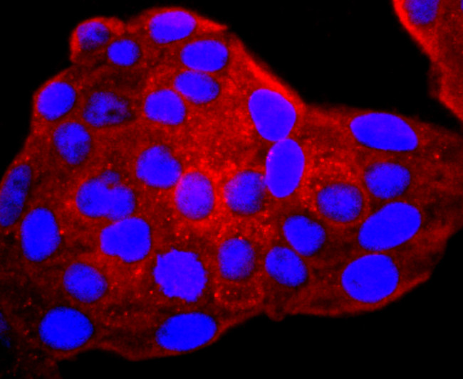 gamma Catenin Antibody in Immunocytochemistry (ICC/IF)