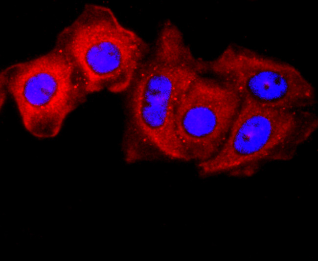 gamma Catenin Antibody in Immunocytochemistry (ICC/IF)