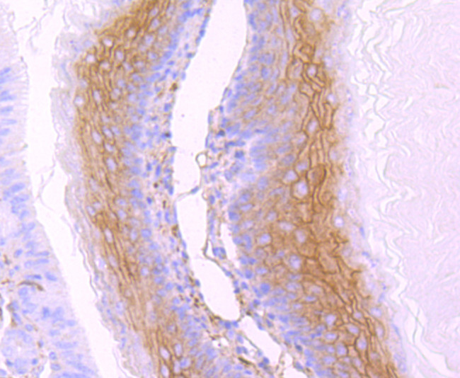 gamma Catenin Antibody in Immunohistochemistry (Paraffin) (IHC (P))