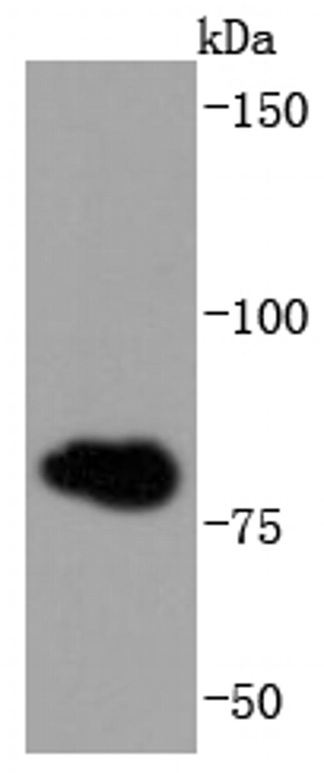 gamma Catenin Antibody in Western Blot (WB)