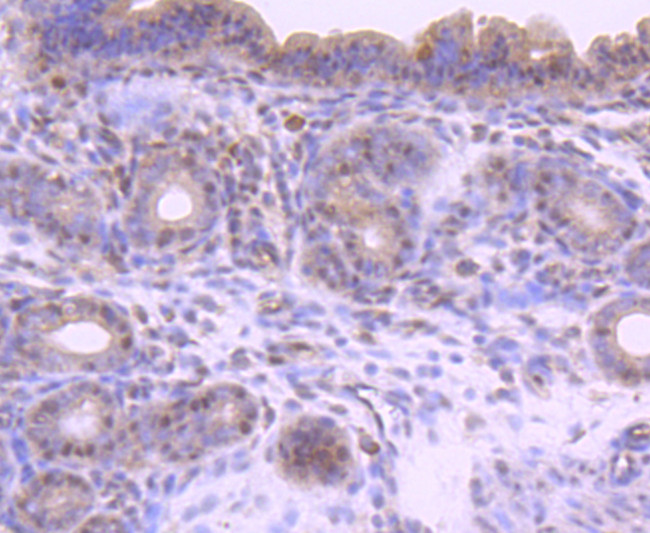 Phospho-SMAD2 (Ser255) Antibody in Immunohistochemistry (Paraffin) (IHC (P))