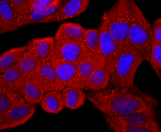 CD99 Antibody in Immunocytochemistry (ICC/IF)