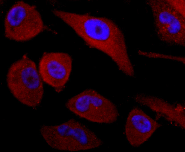 CD99 Antibody in Immunocytochemistry (ICC/IF)