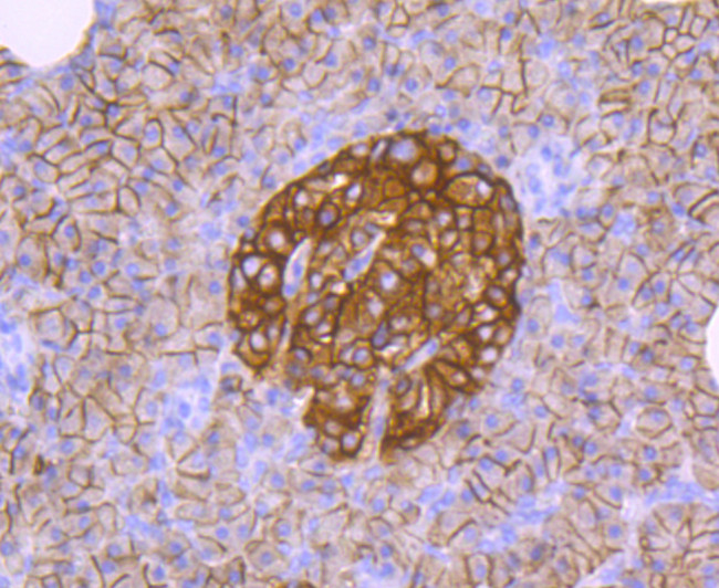 CD99 Antibody in Immunohistochemistry (Paraffin) (IHC (P))