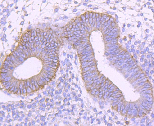 CD99 Antibody in Immunohistochemistry (Paraffin) (IHC (P))