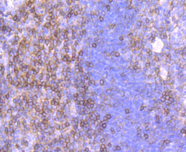 CD99 Antibody in Immunohistochemistry (Paraffin) (IHC (P))