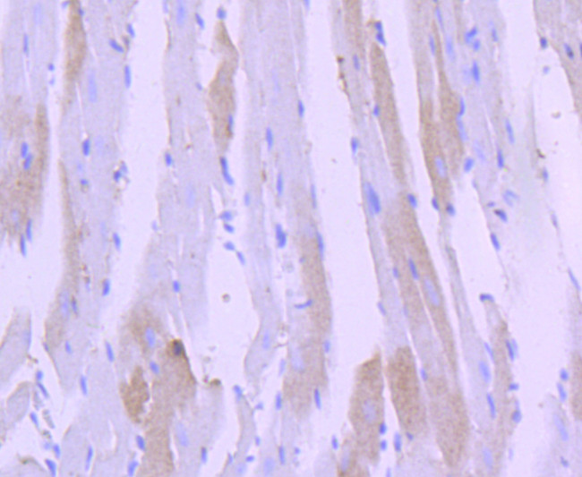 Cardiac Troponin I Antibody in Immunohistochemistry (Paraffin) (IHC (P))